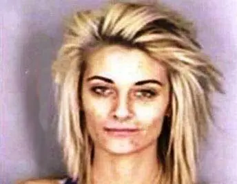Miss-Face-of-Heroin-addiction-Photo