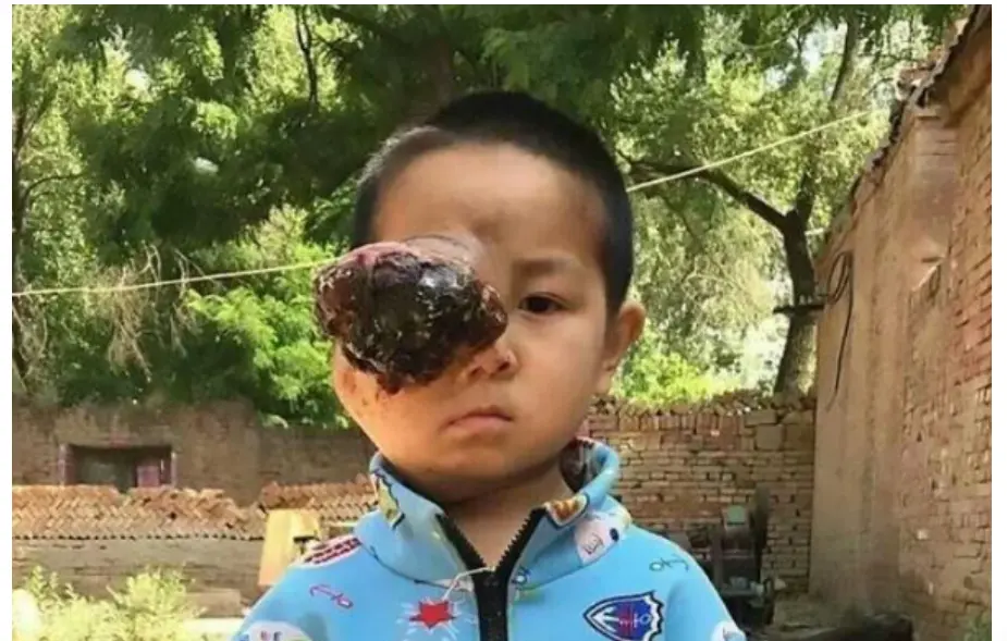 چشم7