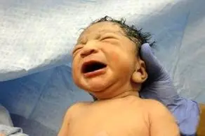 تولد نوزادی عجیب الخلقه با دم دراز و عجیب/ عکس