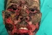 دکتر ناشی دختر بیچاره را تا می‌توانست زشت کرد!+ عکس ترسناک