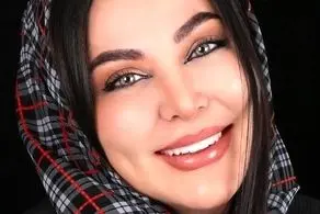تصاویری از زیباترین بازیگر زن سینما قبل از عمل چهره/ عکس