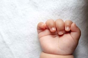 نوزاد ریش و سبیلو به دنیا آمد!/ تصاویر ترسناک