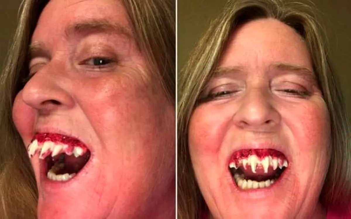 جا ماندن دندان وحشتناک زامبی داخل دهان این یک زن مسن!+ عکس
