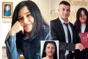 ازدواج دردناک دختر 20 ساله با پسری که زیبایش را نابود کرد+عکس