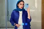  ترلان پروانه موهایش را زد!/ عکس