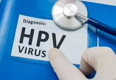 ماجرای شیوع بالای HPV در تهران چیست؟