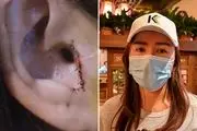 در جراحی عجیب بینی این زن جوان گوش او را کندند!+عکس