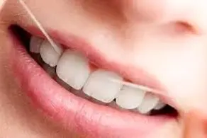 داماد: عروس را به شرط سلامت دندانهایش به خانه می‌برم!