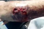 حمله وحشتناک گرگ به ۶ نفر در اردستان+ عکس دلخراش