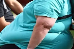 احتمال مرگ افراد چاق کرونایی 10 برابر لاغرهاست!