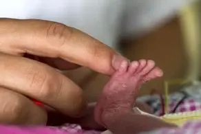 سنگ شدن عجیب و دردناک نوزاد زیبا!