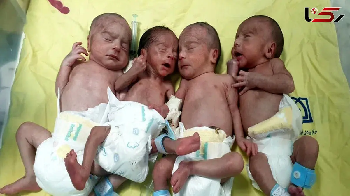 استان قزوین رکورد دار تولد چهارقلوها/ مادر 27 ساله 4 قلو زایید!