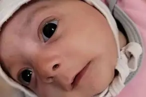 رهاکردن نوزاد 2 ماهه‌ای که روی سرش جای جراحی و بخیه داشت + عکس