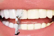 متفاوت‌ترین دندان مصنوعی دنیا را ببینید تا وحشت کنید+ عکس