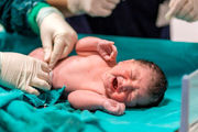 تولد ترسناک ترین نوزاد دنیا+ عکس 