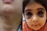 کتک و آزار وحشتناک دختر بچه  ۹ ساله در سنندج/ پدر همسر باردار را از خانه بیرون کرد،+عکس و جزئیات