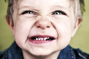 درمان دندان قروچه کودکان