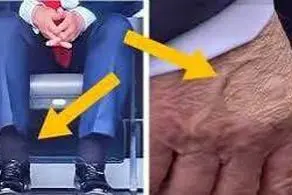 بیماری ترامپ خبرساز شد + عکس 
