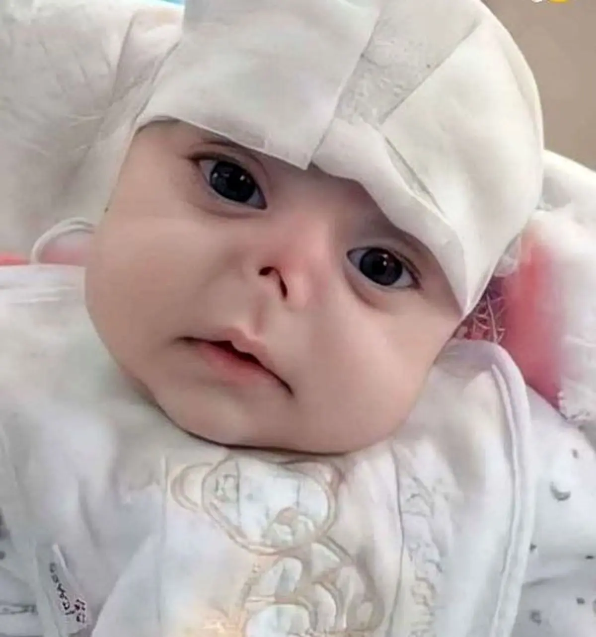 موش دماغ این نوزاد زیبا را خوردند!+عکس دلخراش