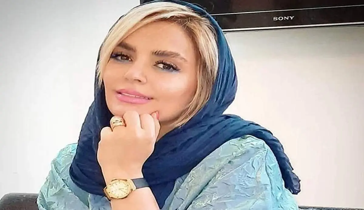 تغییر چهره سپیده خداوردی بعد از عملهای زیبایی/ عکس