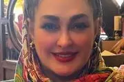 عکس جنجالی| کتک خوردن شدید خانم بازیگر معروف در جشنواره فیلم فجر!/ چه بلایی بر سر الهام حمیدی آمده است؟